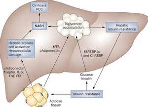 non_alcoholic_fatty_liver